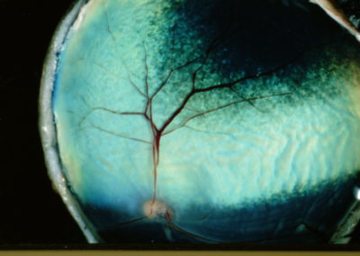 A blue-green layer of tissue in the eye